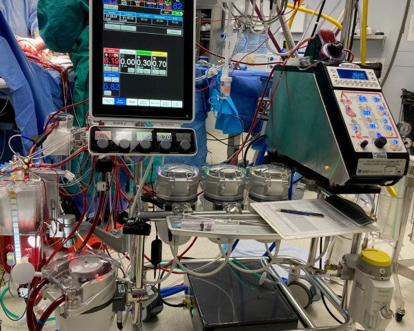 This is an image of a 'heart-lung machine,' there are tubes and electronic screens all connected together. The machine is sitting in an operating room.